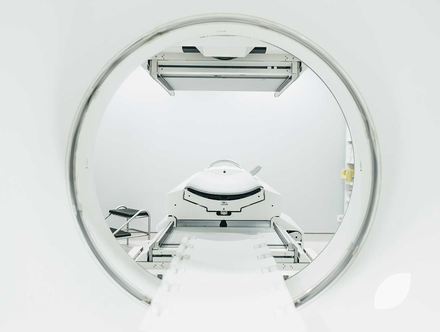 Radiology St Peitonectomy